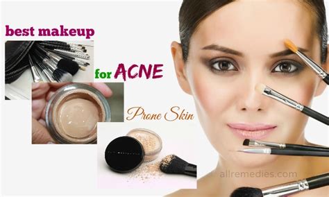 best makeup for acne prone skin dermatologist.